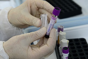 О расширении сети лабораторий для тестирования на новую коронавирусную инфекцию
